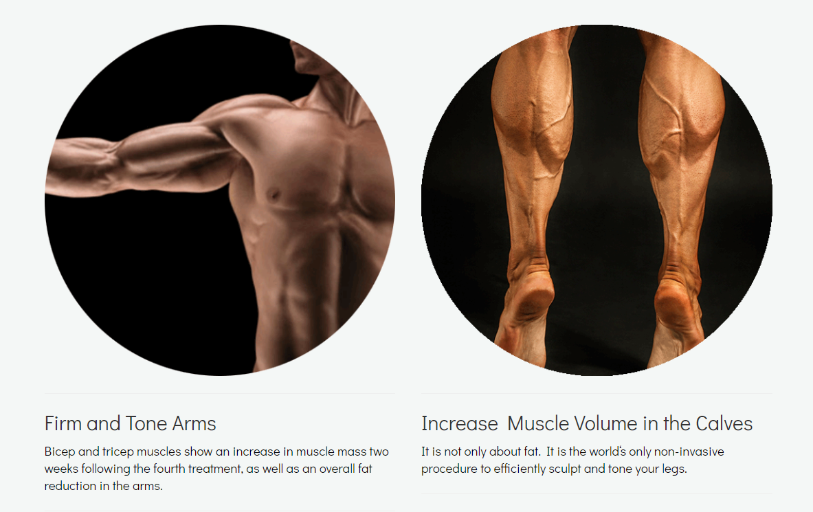 EMSCULPT Body Toning & Sculpting - SkinRX Aesthetic Clinic PTY (LTD)