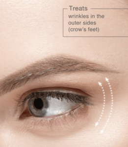 PERIOCULAR