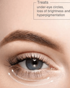 PERIOCULAR